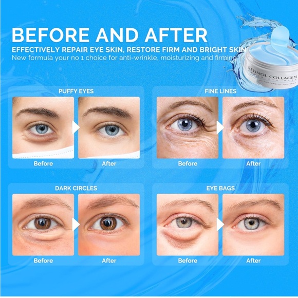 Retinol collagen under eye mask NWT - Picture 2 of 6